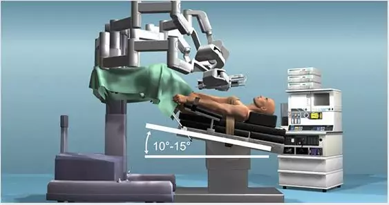 Robotic Prostatectomy - On Operating Table